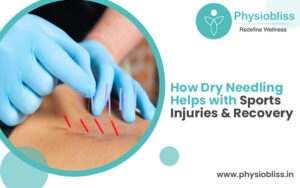 Dry Needling
